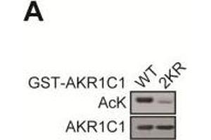 Western Blotting (WB) image for anti-Dihydrodiol Dehydrogenase (DDH) antibody (ABIN2856139)