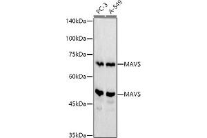 Western blot analysis of extracts of various cell lines, using MAVS antibody (ABIN6132297, ABIN6143583, ABIN6143584 and ABIN6221441) at 1:500 dilution. (MAVS antibody  (AA 1-65))