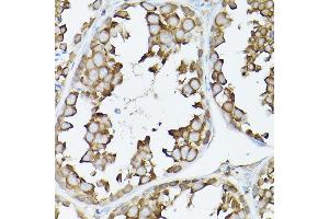 Immunohistochemistry of paraffin-embedded rat testis using GARS Rabbit pAb (ABIN6127942, ABIN6140964, ABIN6140966 and ABIN6221085) at dilution of 1:300 (40x lens). (GARS antibody  (AA 60-370))