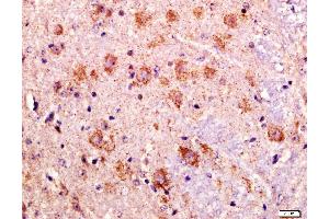 Paraformaldehyde-fixed, paraffin embedded mouse brain tissue, Antigen retrieval by boiling in sodium citrate buffer(pH6) for 15min, Block endogenous peroxidase by 3% hydrogen peroxide for 30 minutes, Blocking buffer (normal goat serum) at 37°C for 20min, Antibody incubation with Rabbit Anti-LAGY Polyclonal Antibody, Unconjugated  at 1:400 overnight at 4°C, followed by a conjugated secondary and DAB staining (HOPX antibody  (AA 25-73))