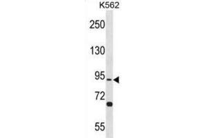 Western Blotting (WB) image for anti-Testis Specific, 10 (TSGA10) antibody (ABIN3001029) (TSGA10 antibody)