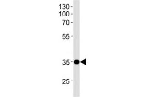 NKX1. (NKX1-1 antibody  (AA 1-1))