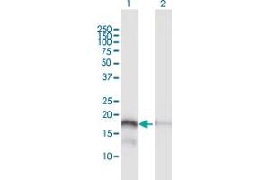 Western Blot analysis of MTP18 expression in transfected 293T cell line by MTP18 MaxPab polyclonal antibody.