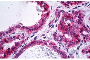 Human Thyroid: Formalin-Fixed, Paraffin-Embedded (FFPE) (alpha Actinin 4 antibody  (AA 592-702))