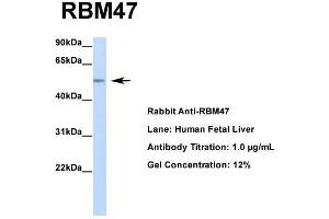 Host: Rabbit  Target Name: RBM47  Sample Tissue: Human Fetal Liver  Antibody Dilution: 1. (RBM47 antibody  (Middle Region))