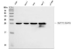 Western blot analysis of HSP27 using anti-HSP27 antibody (ABIN3042464).