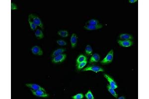 Immunofluorescent analysis of HepG2 cells using ABIN7155160 at dilution of 1:100 and Alexa Fluor 488-congugated AffiniPure Goat Anti-Rabbit IgG(H+L) (HIGD1B antibody  (AA 1-29))