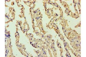 Immunohistochemistry of paraffin-embedded human lung tissue using ABIN7145166 at dilution of 1:100 (Cyclin D1 antibody  (AA 1-233))