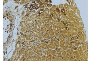 ABIN6273039 at 1/100 staining Mouse kidney tissue by IHC-P. (D2HGDH antibody  (C-Term))