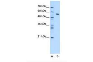 Image no. 1 for anti-Carboxylesterase 1 (CES1) (AA 33-82) antibody (ABIN320684) (CES1 antibody  (AA 33-82))