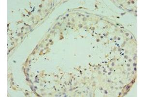 Immunohistochemistry of paraffin-embedded human testis tissue using ABIN7172205 at dilution of 1:100 (TICAM2 antibody  (AA 1-235))
