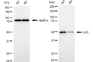 Western blotting analysis using p53 antibody (ABIN7800686). (Recombinant p53 antibody)