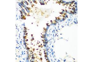 Immunohistochemistry of paraffin-embedded rat lung using MT-CO2 antibody (ABIN4903355) at dilution of 1:100 (40x lens). (COX2 antibody)