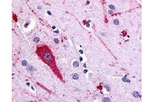 Immunohistochemical (Formalin/PFA-fixed paraffin-embedded sections) staining in human brain (cortex) with HTR5A polyclonal antibody . (Serotonin Receptor 5A antibody)