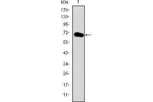 Western blot analysis using GATA5 mAb against human GATA5 (AA: 168-391) recombinant protein. (GATA5 antibody)