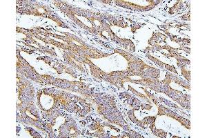 IHC analysis of TXN2 using anti-TXN2 antibody (ABIN7602150). (TXN2 antibody  (AA 60-166))