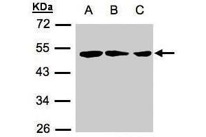 WB Image Sample(30 μg of whole cell lysate) A:239T B:A431 C:H1299 12% SDS PAGE antibody diluted at 1:500