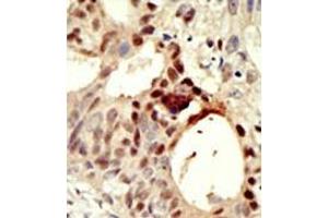 Image no. 1 for anti-DNA (Cytosine-5-)-Methyltransferase 3 Like (TRDMT1) (AA 388-417), (C-Term) antibody (ABIN356577) (DNMT3L antibody  (C-Term))