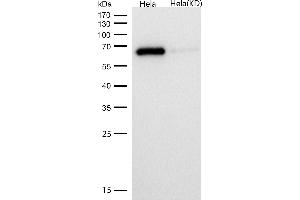 All lanes use the Antibody at 1:1K dilution for 1 hour at room temperature.