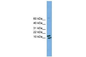 WB Suggested Anti-PPIH Antibody Titration: 0. (PPIH antibody  (Middle Region))
