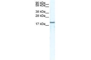 WB Suggested Anti-CXCL14 Antibody Titration:  1 ug/ml  Positive Control:  HepG2 cell lysate (CXCL14 antibody  (Middle Region))