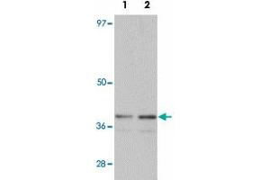 Western blot analysis of SLC39A1 in mouse kidney tissue lysate with SLC39A1 polyclonal antibody  at (1) 1 and (2) 2 ug/mL. (SLC39A1 antibody  (N-Term))