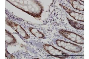 Immunoperoxidase of monoclonal antibody to WDR4 on formalin-fixed paraffin-embedded human small Intestine. (WDR4 antibody  (AA 1-266))