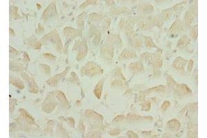 Immunohistochemistry of paraffin-embedded human heart tissue using ABIN7169199 at dilution of 1:100 (TNNI3K antibody  (AA 1-75))