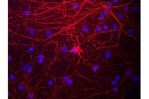 View of mixed neuron/glial cultures stained with NEFM / NF-M antibody (red). (NEFM antibody)