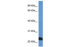 Western Blot showing PRSS1 antibody used at a concentration of 1 ug/ml against Jurkat Cell Lysate (PRSS1 antibody  (N-Term))