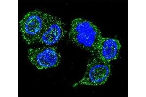 Confocal immunofluorescent analysis of JNK1 antibody with HepG2 cells followed by Alexa Fluor 488-conjugated goat anti-rabbit lgG (green). (JNK antibody  (AA 358-389))