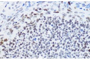Immunohistochemistry of paraffin-embedded Rat ovary using Acetyl-Histone H4-K12 Polyclonal Antibody at dilution of 1:200 (40x lens). (Histone H4 antibody  (acLys12))