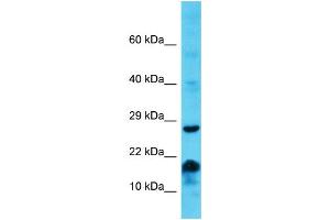 Host: Rabbit Target Name: MS4A6E Sample Type: Jurkat Whole Cell lysates Antibody Dilution: 1. (MS4A6E antibody  (Middle Region))