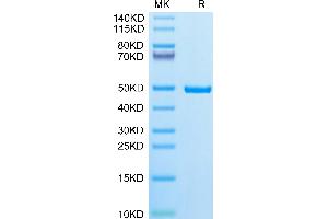 Human IDH1 on Tris-Bis PAGE under reduced condition. (IDH1 Protein (AA 2-414) (His tag))