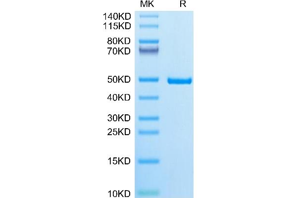 IDH1 Protein (AA 2-414) (His tag)