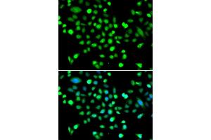 Immunofluorescence analysis of MCF-7 cells using PRK antibody (ABIN6132517, ABIN6146187, ABIN6146188 and ABIN6223135). (PRKAG1 antibody  (AA 1-331))