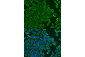 Immunofluorescence analysis of U2OS cells using ALOXE3 antibody. (ALOXE3 antibody  (AA 1-280))