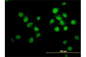 Immunofluorescence of monoclonal antibody to OXSR1 on HeLa cell. (OXSR1 antibody  (AA 1-527))