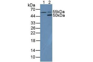 Western blot analysis of (1) Human HL-60 Cells and (2) Mouse Spleen Tissue. (CD4 antibody  (AA 26-396))