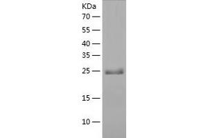 Western Blotting (WB) image for Sarcoglycan, beta (43kDa Dystrophin-Associated Glycoprotein) (SGCB) (AA 87-318) protein (His tag) (ABIN7287341) (SGCB Protein (AA 87-318) (His tag))
