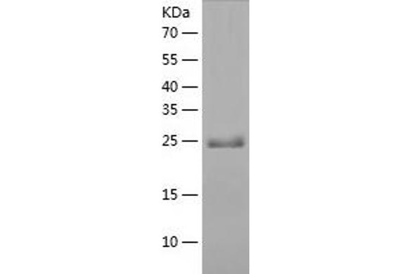 SGCB Protein (AA 87-318) (His tag)