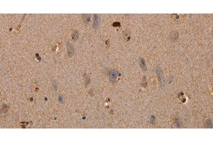 Immunohistochemistry of paraffin-embedded Human brain tissue using PLXNA1 Polyclonal Antibody at dilution 1:30 (Plexin A1 antibody)