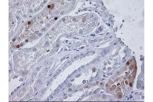 Immunohistochemical staining of paraffin-embedded Human Kidney tissue using anti-PGAM2 mouse monoclonal antibody. (PGAM2 antibody)