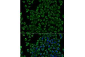 Immunofluorescence analysis of U2OS cells using TCN2 Polyclonal Antibody (TCN2 antibody)