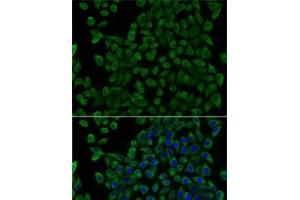 Immunofluorescence analysis of U2OS cells using TCN2 Polyclonal Antibody