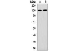 Western blot analysis of Collagen 1 alpha 1/2 expression in HEK293T (A), Hela (B) whole cell lysates. (Collagen 1 alpha 1/2 antibody)