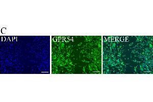 KP inhibits trophoblast migration. (KISS1R antibody  (C-Term))