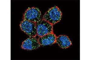 Confocal immunofluorescent analysis of Estrogen Receptor antibody with ZR-75-1 cells followed by Alexa Fluor 488-conjugated goat anti-rabbit lgG (green). (Estrogen Receptor alpha antibody  (AA 246-273))