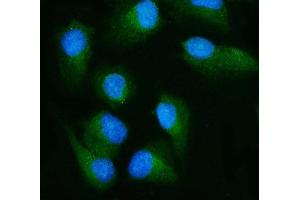 IF analysis of RALBP1 using anti-RALBP1 antibody (ABIN7600800).