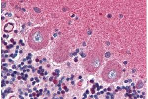 Human Brain, Cerebellum (formalin-fixed, paraffin-embedded) stained with GRIA2 antibody ABIN351533 at 1:50 followed by biotinylated anti-mouse IgG secondary antibody ABIN481714, alkaline phosphatase-streptavidin and chromogen. (GRIA2 antibody  (AA 175-430))